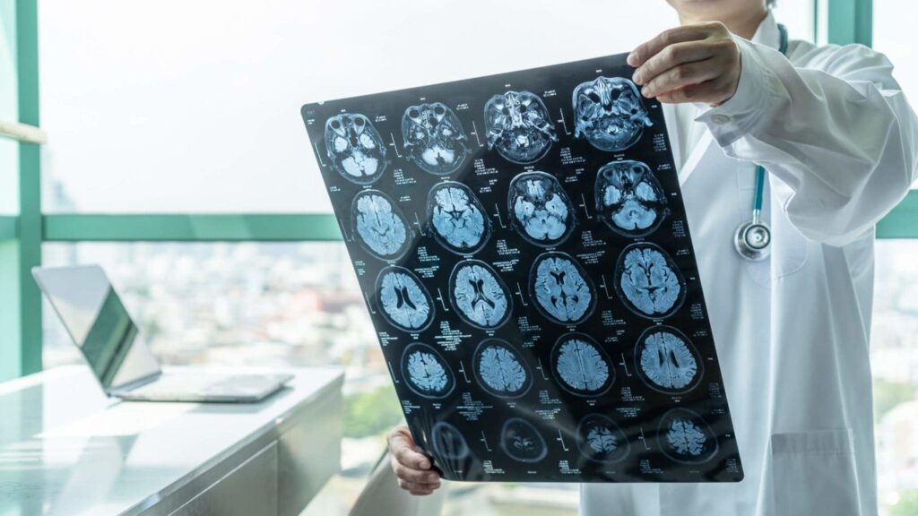 Traumatic Brain Injury Attorney Austin 1024x576